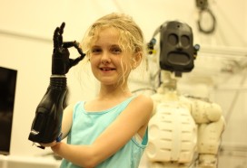 Photo of 10 year old Tilly with robotic hand
