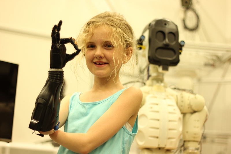 Photo of 10 year old Tilly with robotic hand