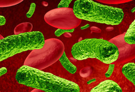 Sepsis