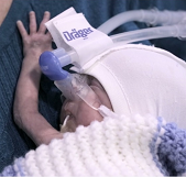 Preterm baby - evaluation case studies