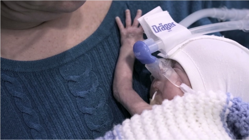 preventing cerebral palsy in preterm births